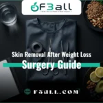 Skin Removal After Weight Loss